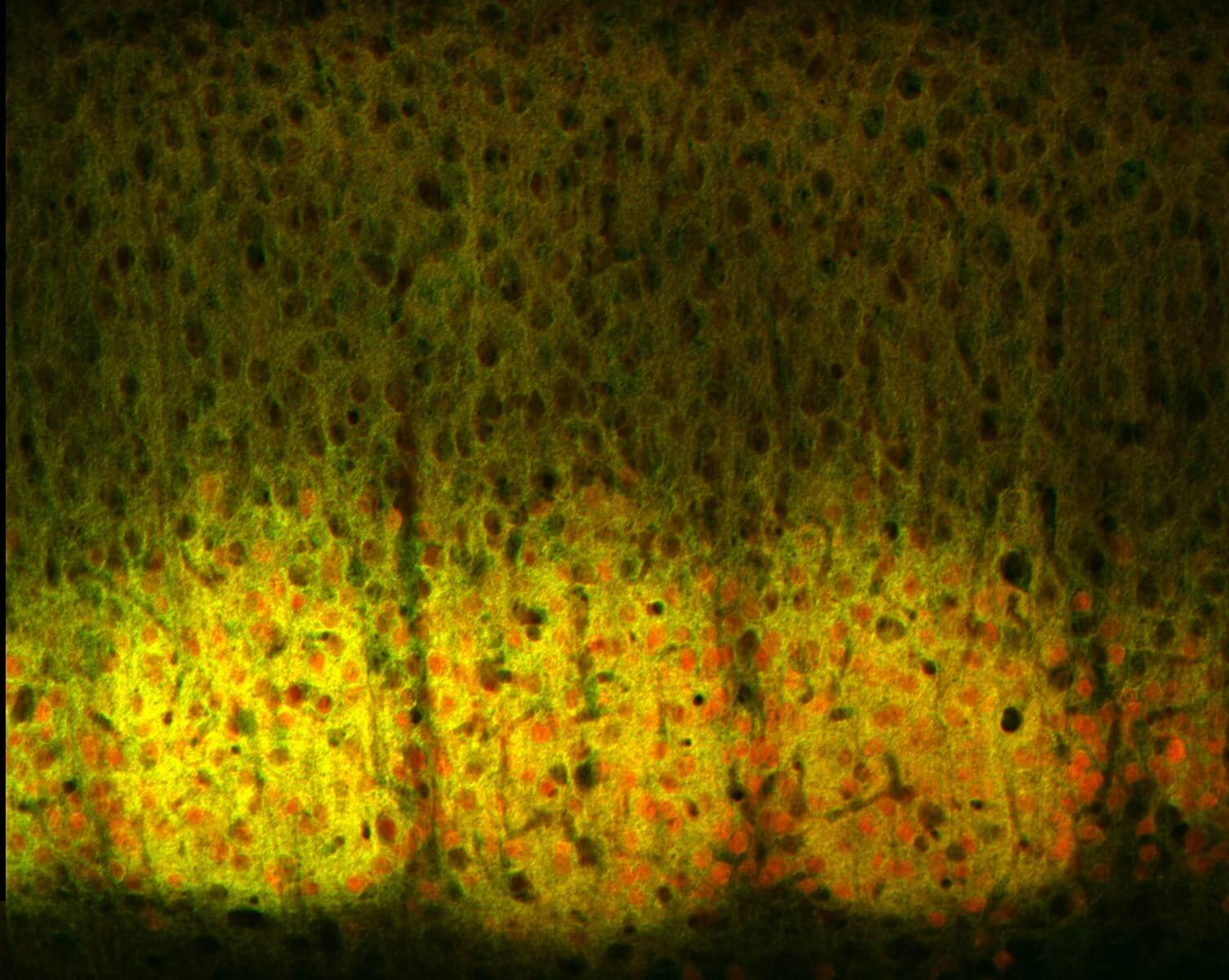 Fluorescent microscopy of oval-shaped orange cell structures within a yellow-green matrix.
