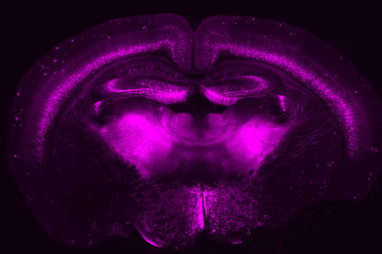 Fluorescent microscopy of a brain slice, colored purple.