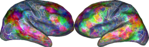 Two depictions of brains, with several regions outlined in white and blotches of different colored areas.