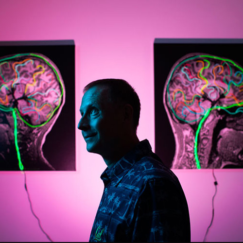 Michael Silver with images of multicolored scans of human brains on either side of him.