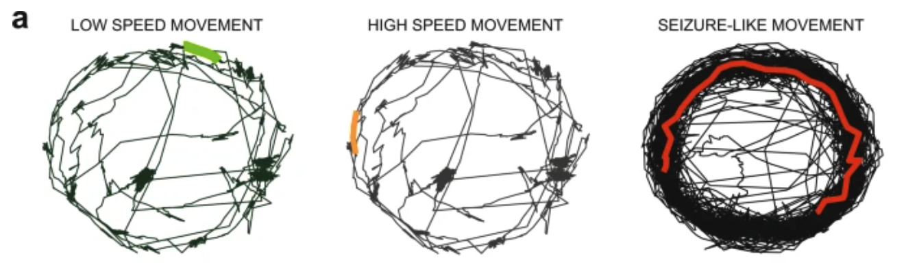 Three sets of black lines, roughly in the shape of circles, labeled respectively: low speed movement, high speed movement, and seizure-like movement. Low speed and high speed movement are both thin circles, and seizure-like movement is a thick circle.