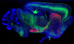 Fluorescence microscopy image of a sagittal section of a mouse brain, showing cells labeled in green, red, and blue.