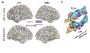 Panel A shows many small purple and white circles distributed across four brain reconstructions shown in two columns and two rows. The columns are labeled Left and Right and the rows are labeled Lateral View and Medial View. Panel B shows a multicolored reconstruction of the medial temporal lobe, labeled Right and Left with an arrow labeled Anterior pointing diagonally down. There are purple and white balls distributed across the reconstruction on both the right and left sides.
