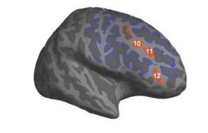 An illustration of a brain, with three sulci near each other towards the front and side outlined and labeled 10, 11, and 12.